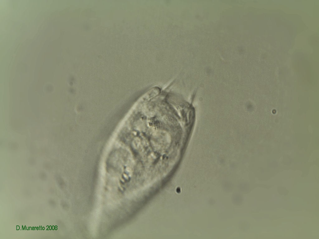 Vorticella in varie fasi di apertura